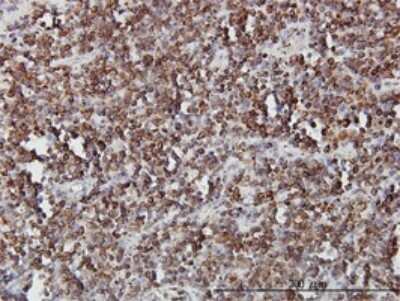 Immunohistochemistry-Paraffin: SLC44A2 Antibody (3D11) [H00057153-M01]