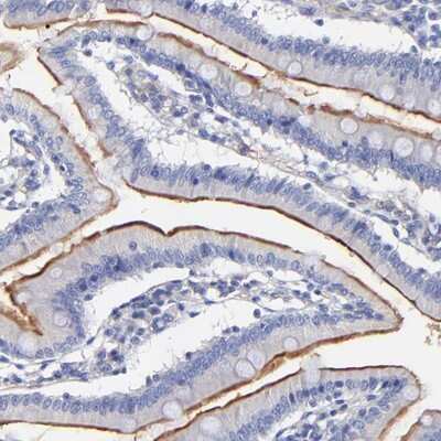 Immunohistochemistry-Paraffin: SLC44A2 Antibody [NBP1-84337]