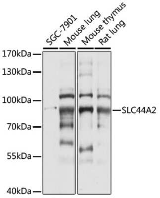 Western Blot: SLC44A2 AntibodyAzide and BSA Free [NBP2-94586]