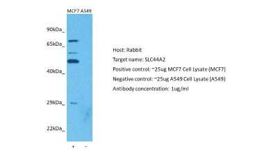 Western Blot: SLC44A2 Antibody [NBP3-10576]