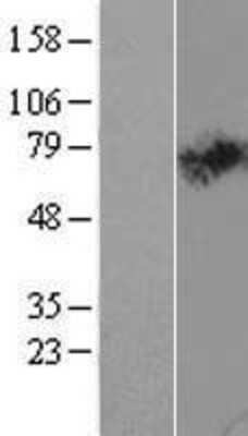 Western Blot: SLC44A2 Overexpression Lysate [NBL1-16161]