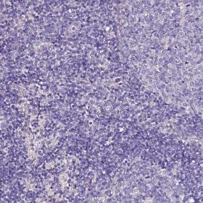Immunohistochemistry-Paraffin: SLC44A3 Antibody [NBP2-13339]