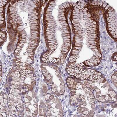 Immunohistochemistry-Paraffin: SLC44A3 Antibody [NBP2-13339]