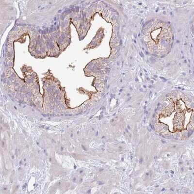 Immunohistochemistry-Paraffin: SLC44A4 Antibody [NBP2-33476]