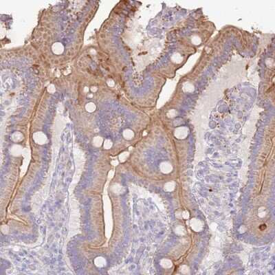 Immunohistochemistry-Paraffin: SLC44A4 Antibody [NBP2-33476]