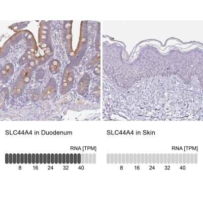 Immunohistochemistry-Paraffin: SLC44A4 Antibody [NBP2-33476]