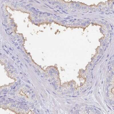 Immunohistochemistry-Paraffin: SLC44A4 Antibody [NBP2-33707]