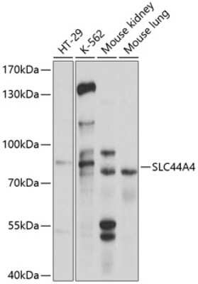 Western Blot: SLC44A4 AntibodyBSA Free [NBP2-93492]