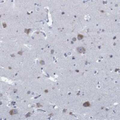 Immunohistochemistry-Paraffin: SLC45A1 Antibody [NBP3-17174]