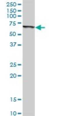 Western Blot: SLC45A2 Antibody [H00051151-D01P]