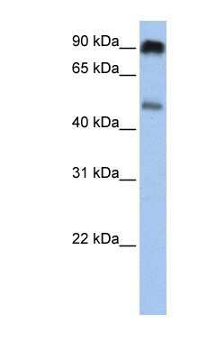 Western Blot: SLC45A2 Antibody [NBP1-59786]