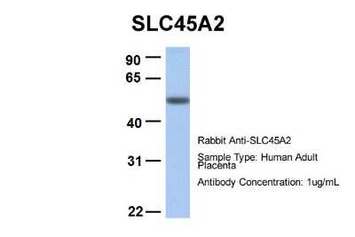Western Blot: SLC45A2 Antibody [NBP1-59786]