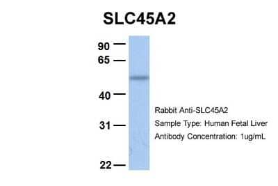 Western Blot: SLC45A2 Antibody [NBP1-59786]