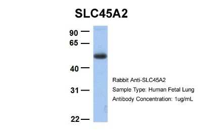 Western Blot: SLC45A2 Antibody [NBP1-59786]