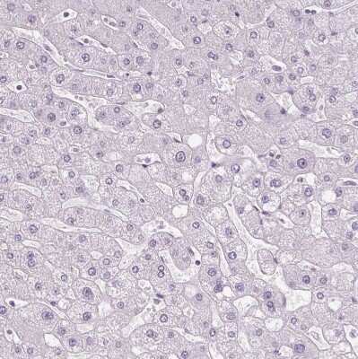 Immunohistochemistry-Paraffin: SLC45A3/Prostein Antibody [NBP1-89629]