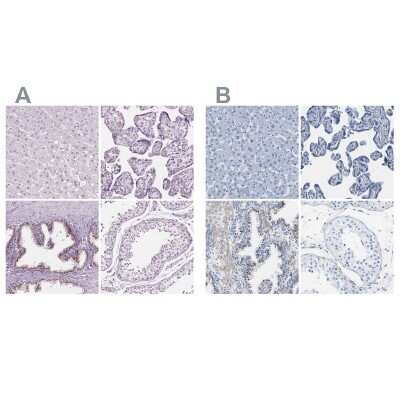 Immunohistochemistry-Paraffin: SLC45A3/Prostein Antibody [NBP1-89629]