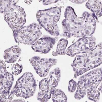 Immunohistochemistry-Paraffin: SLC45A3/Prostein Antibody [NBP1-89629]