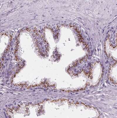 Immunohistochemistry-Paraffin: SLC45A3/Prostein Antibody [NBP1-89629]