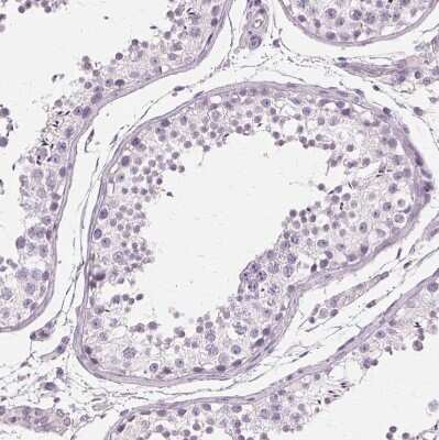 Immunohistochemistry-Paraffin: SLC45A3/Prostein Antibody [NBP1-89629]