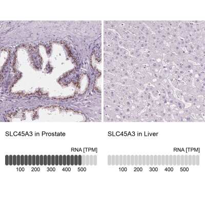 Immunohistochemistry-Paraffin: SLC45A3/Prostein Antibody [NBP1-89629]