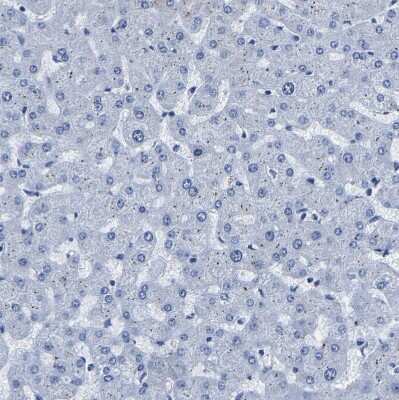 Immunohistochemistry-Paraffin: SLC45A3/Prostein Antibody [NBP1-89630]