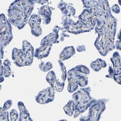 Immunohistochemistry-Paraffin: SLC45A3/Prostein Antibody [NBP1-89630]