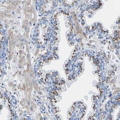 Immunohistochemistry-Paraffin: SLC45A3/Prostein Antibody [NBP1-89630]