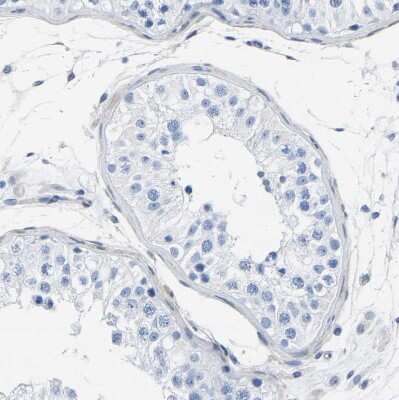 Immunohistochemistry-Paraffin: SLC45A3/Prostein Antibody [NBP1-89630]