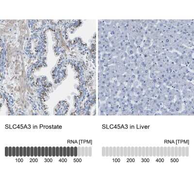 Immunohistochemistry-Paraffin: SLC45A3/Prostein Antibody [NBP1-89630]