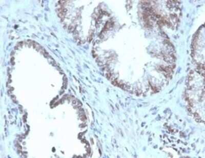 Immunohistochemistry-Paraffin: SLC45A3/Prostein Antibody (SLC45A3/4965R) [NBP3-13803]