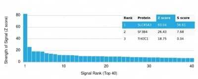 Protein Array: SLC45A3/Prostein Antibody (SLC45A3/7176R) - Azide and BSA Free [NBP3-14049]