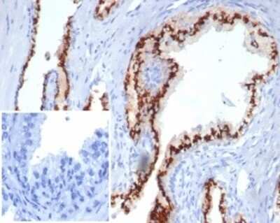 Immunohistochemistry-Paraffin: SLC45A3/Prostein Antibody (SLC45A3/7176R) [NBP3-13804]