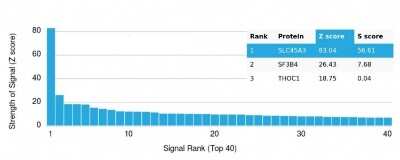 Protein Array: SLC45A3/Prostein Antibody (SLC45A3/7176R) [NBP3-13804]