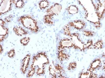 Immunohistochemistry-Paraffin: SLC45A3/Prostein Antibody (ZR9) - Azide and BSA Free [NBP3-08542]