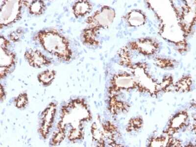 Immunohistochemistry-Paraffin: SLC45A3/Prostein Antibody (ZR9) [NBP3-07403]