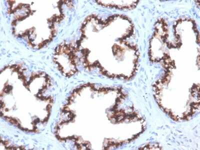 Immunohistochemistry-Paraffin: SLC45A3/Prostein Antibody (ZR9) [NBP3-07403]