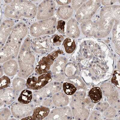 Immunohistochemistry-Paraffin: SLC45A4 Antibody [NBP1-82927]