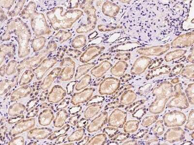 Immunohistochemistry-Paraffin: SLC45A4 Antibody [NBP2-98631]