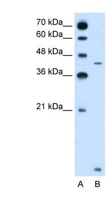 Western Blot: SLC46A3 Antibody [NBP1-80531]