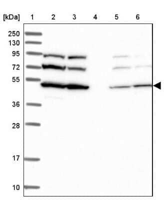 Western Blot: SLC46A3 Antibody [NBP1-85054]