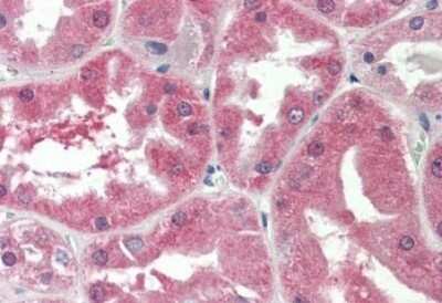 Immunohistochemistry-Paraffin: SLC47A2 Antibody [NBP1-97763]