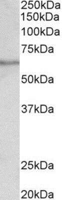 Western Blot: SLC47A2 Antibody [NBP1-97761]