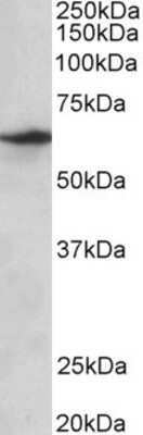 Western Blot: SLC47A2 Antibody [NBP1-97763]