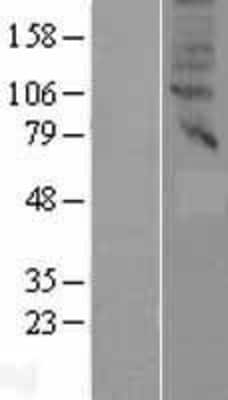 Western Blot: SLC47A2 Overexpression Lysate [NBP2-05295]