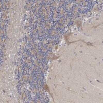 Immunohistochemistry-Paraffin: SLC48A1 Antibody [NBP3-17621]