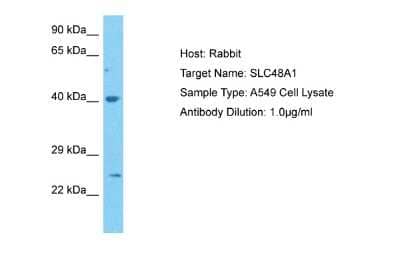 Western Blot: SLC48A1 Antibody [NBP1-91563]