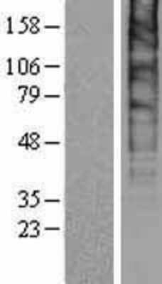 Western Blot: SLC48A1 Overexpression Lysate [NBP2-04365]