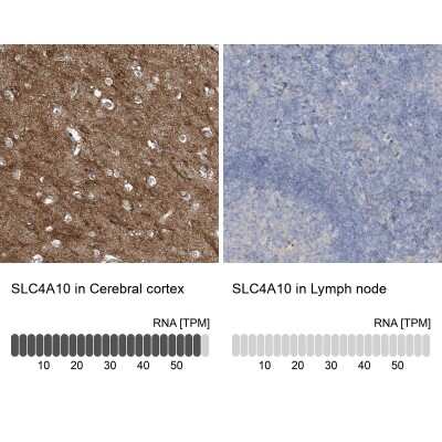 Immunohistochemistry-Paraffin: SLC4A10 Antibody [NBP1-82594]