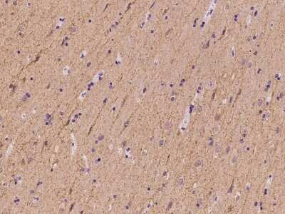 Immunohistochemistry-Paraffin: SLC4A10 Antibody [NBP2-98632]