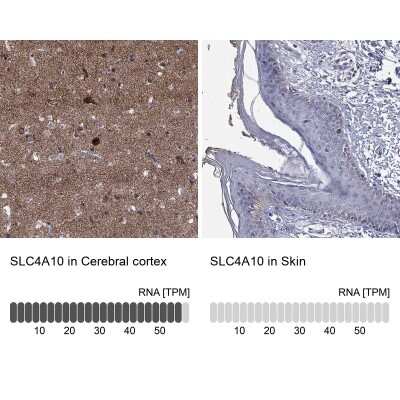 Immunohistochemistry-Paraffin: SLC4A10 Antibody [NBP3-17116]